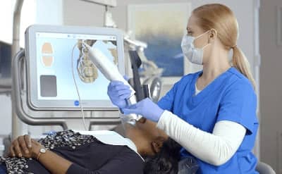 口腔内3Dスキャナー iTero