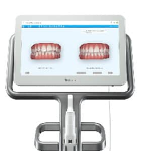 口腔内3Dスキャナー iTero