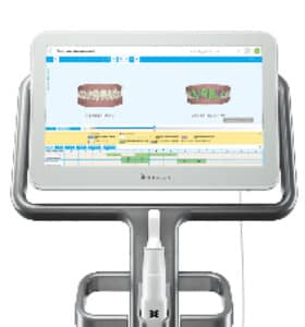 口腔内3Dスキャナー iTero