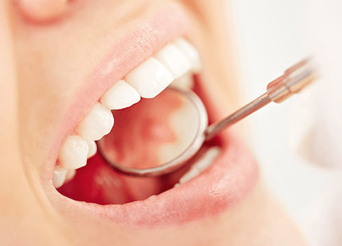 矯正器具の撤去および精密検査