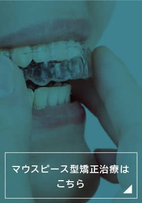マウスピース型矯正治療