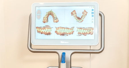 口腔内3DスキャナーiTeroの導入